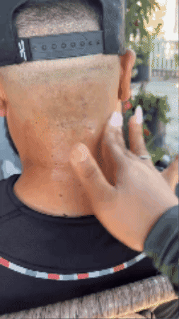 Dr. Melaxin - 🔥 El spray exfoliante que transforma tu piel desde casa